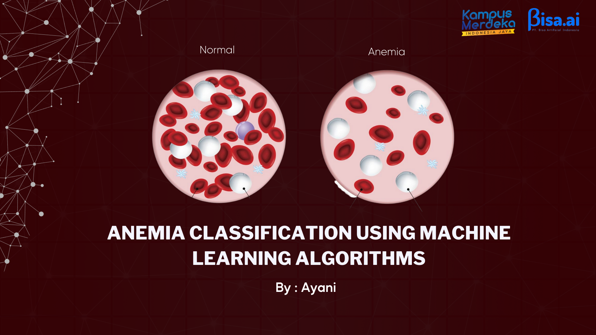 Portofolio :: Anemia Classification using Machine Learning